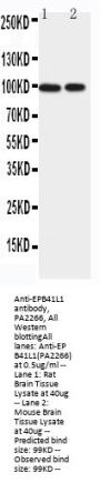 Anti-Band 4.1-like protein 1 EPB41L1 Antibody