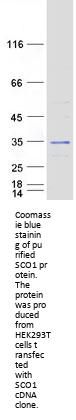SCO1 SCO Cytochrome Oxidase Deficient Homolog 1 Human Recombinant Protein