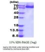 AFP Alpha-Fetoprotein Human