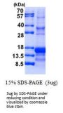 Inhibin-a Inhibin Alpha Human Recombinant Protein