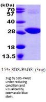 CYSH Phosphoadenosine phosphosulfate reductase E.Coli Recombinant Protein