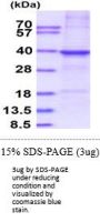 CTSS Cathepsin-S Human Recombinant Protein