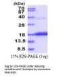 CDA Cytidine Deaminase Human Recombinant Protein