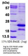 MAGEA5 Melanoma Antigen Family A, 5 Human Recombinant Protein