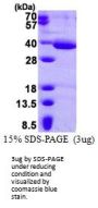 HAAO 3-Hydroxyanthranilate 3,4-Dioxygenase Human Recombinant Protein