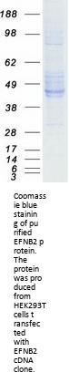 EFNB2 Ephrin- B2 Human Recombinant Protein