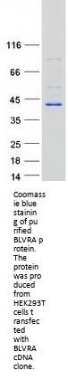 BLVRA Biliverdin Reductase A Human Recombinant Protein