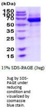 EPHB4 EPH Receptor B4 Mouse Recombinant Protein