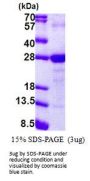 LY6G6F Lymphocyte Antigen 6 Complex Locus G6F Human Recombinant Protein