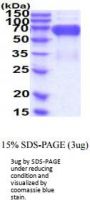 CD276 Human Recombinant Protein