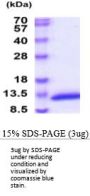 CAMK2N1 Calcium/Calmodulin-Dependent Protein Kinase II Inhibitor 1 MouseRecombinant Protein