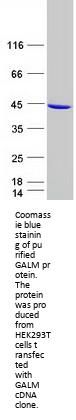 GALM Galactose Mutarotase Human Recombinant Protein