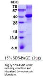 Amnion Associated Transmembrane Protein Human Recombinant Protein