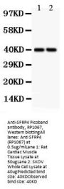 Anti-SFRP4 Antibody