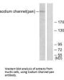 SCN5A Antibody