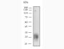 Anti-Mouse CTLA-4 (UC10-4F10-11) In Vivo Antibody - Low Endotoxin