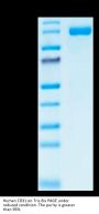 Human CD31/PECAM-1 Protein (CD3-HM231)