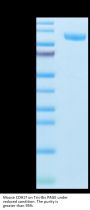 Mouse CDH17/Cadherin 17 Protein (CDH-MM117)