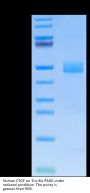 Human CTGF/CCN2 Protein (CGF-HM101)