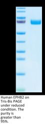 Human EPHB2 Protein (EPH-HM101)