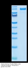 Human Her2/ErbB2 Protein (HER-HM202)