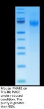 Mouse IFN alpha/beta R1 Protein (IFN-MM4R1)