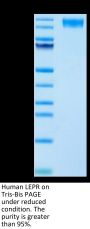 Human LEPR Protein (LEP-HM10R)