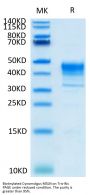 Biotinylated Cynomolgus MSLN/Mesothelin Protein (Primary Amine Labeling) (MSL-CM180B)